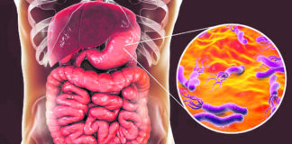 Tinc mal de panxa i m’han trobat helicobacter pylori, què és ?