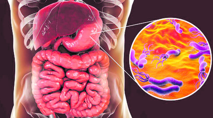 Tinc mal de panxa i m’han trobat helicobacter pylori, què és ?