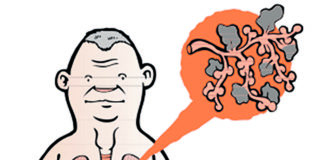 MPOC….i això què vol dir?