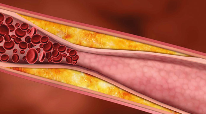 La hipertensió també resta qualitat i anys de vida